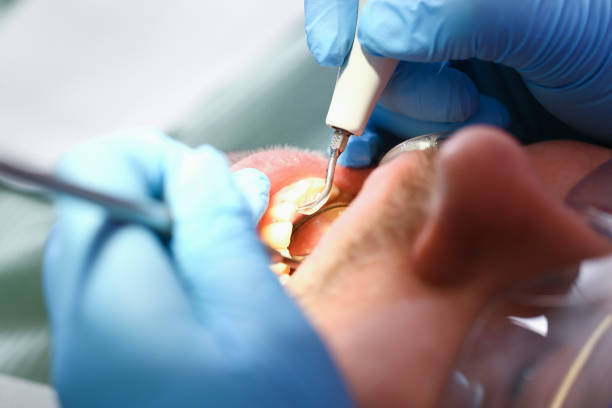 Best Emergency Dental Care for Broken or Chipped Teeth in Laguna Park, TX