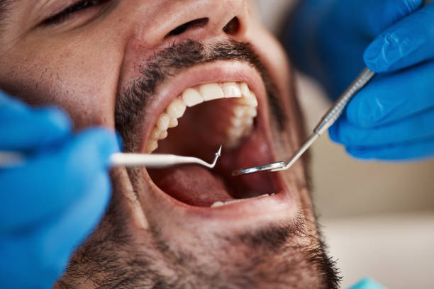 Best After-Hours Dental Trauma Care in Laguna Park, TX